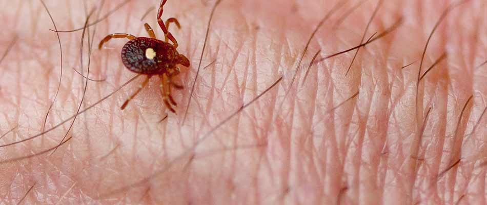 Lone star tick crawling on a person's arm in Watchung, NJ.