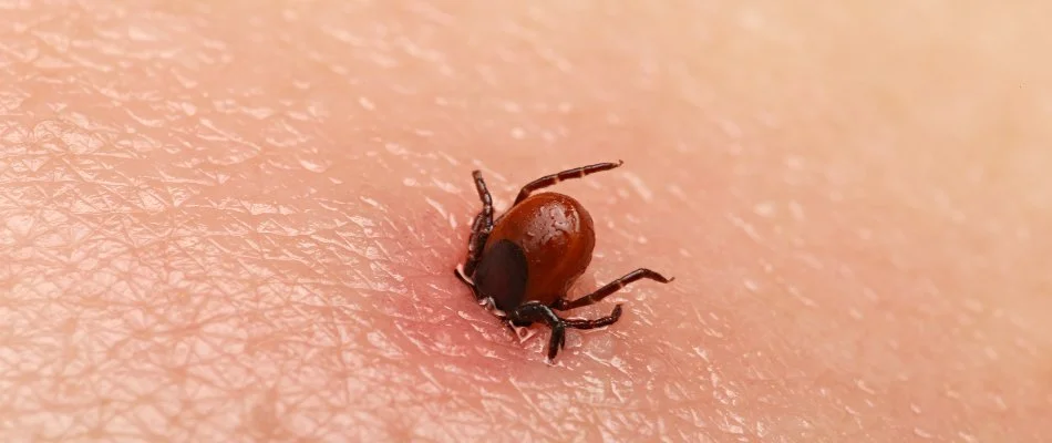 Tick burrowing in the skin of a person in Westfield, NJ.
